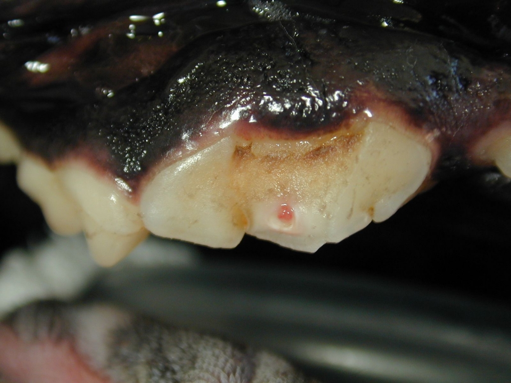 Contaminated pulp tissue is removed from the pulp cavity. Contaminated pulp tissue is removed from the pulp cavity.