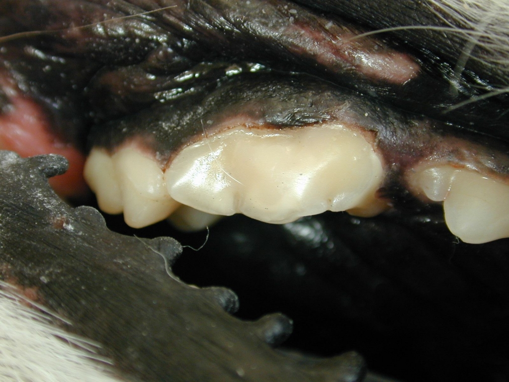 A restoration is placed and the tooth reshaped. A restoration is placed and the tooth reshaped.