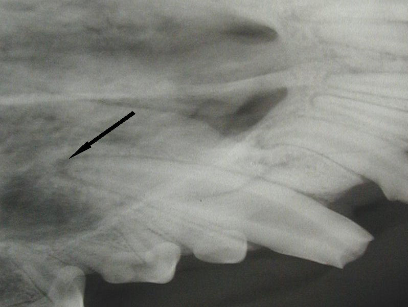 Fractured Tooth Radiograph