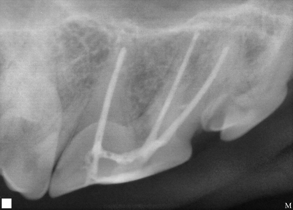 The pulp cavity is then sanitized and filled with biologically inert filling preventing further bacterial contamination of surrounding bone. The pulp cavity is then sanitized and filled with biologically inert filling preventing further bacterial contamination of surrounding bone.