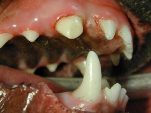 tooth following the "root canal" procedure 