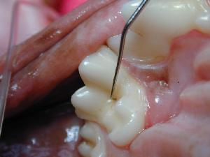 Restorative Dentistry Restorative Dentistry