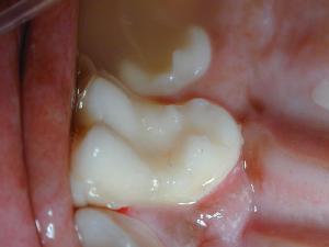 Restorative Dentistry Restorative Dentistry