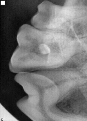 Restorative Dentistry Restorative Dentistry