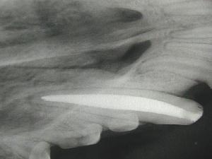  post-op radiograph 