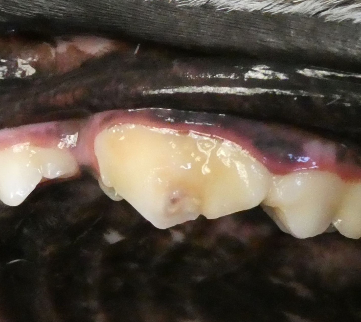fractured tooth