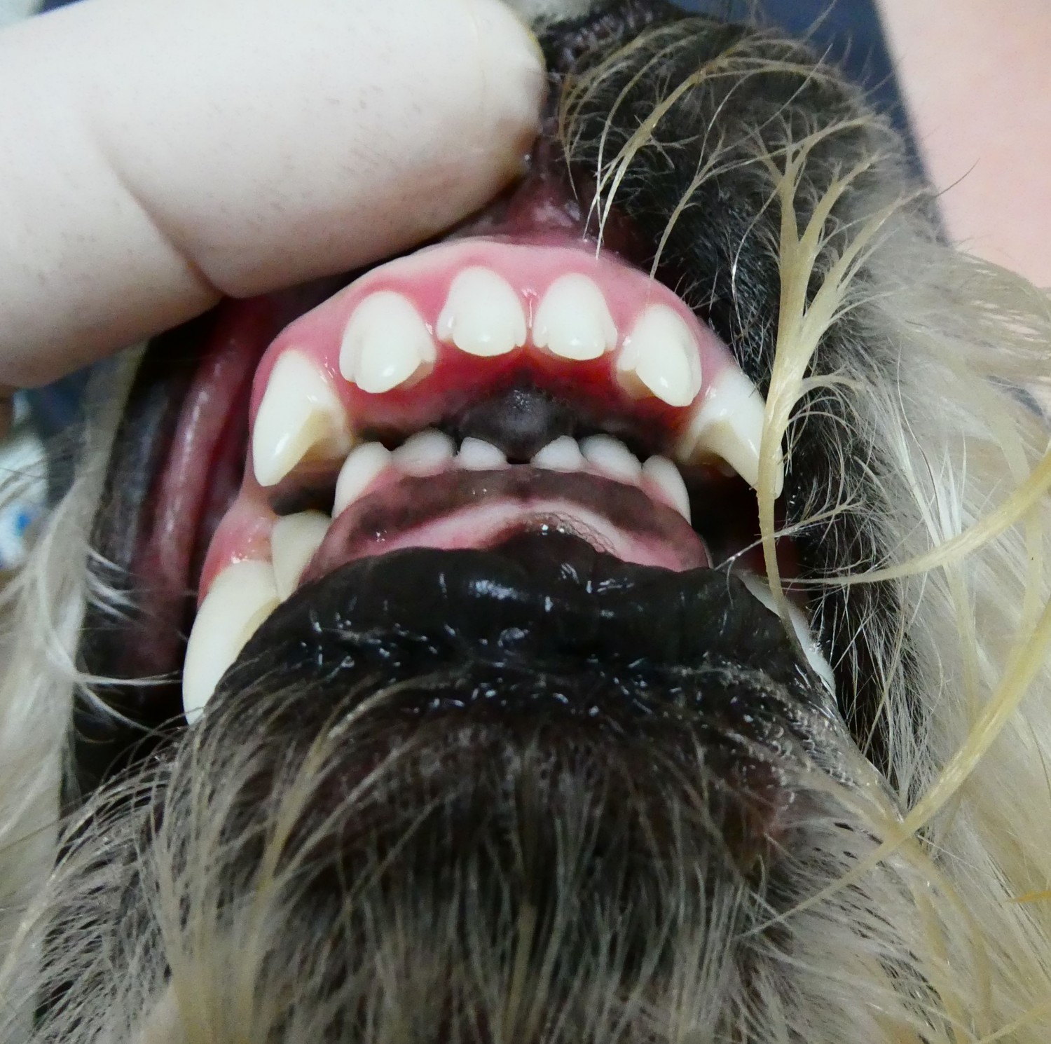 Malocclusion 