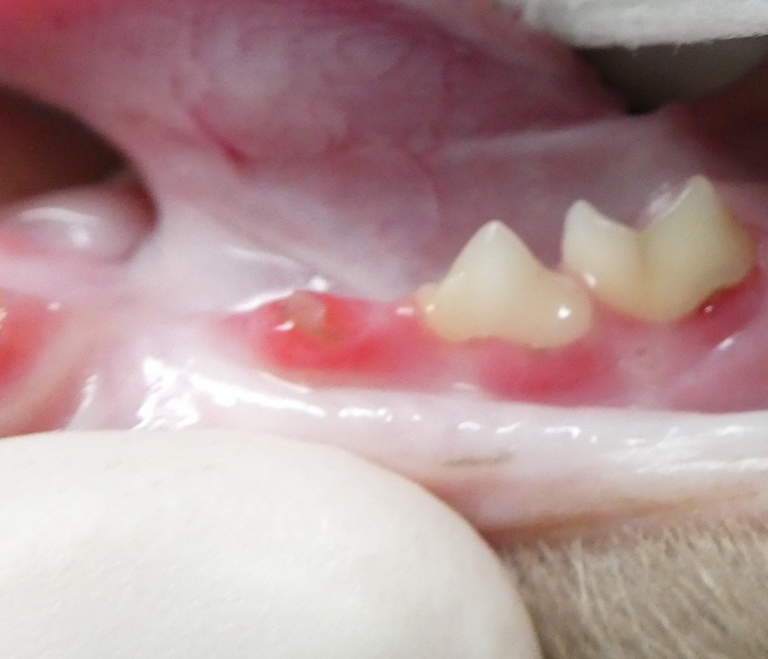 tooth resorption 