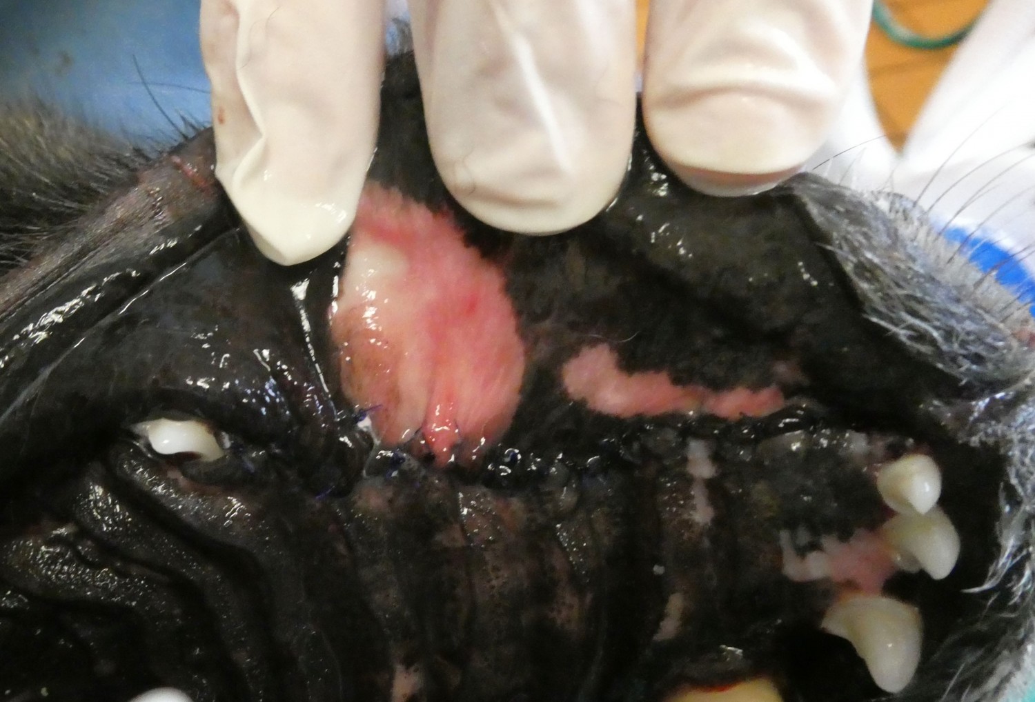 after oral mass removal