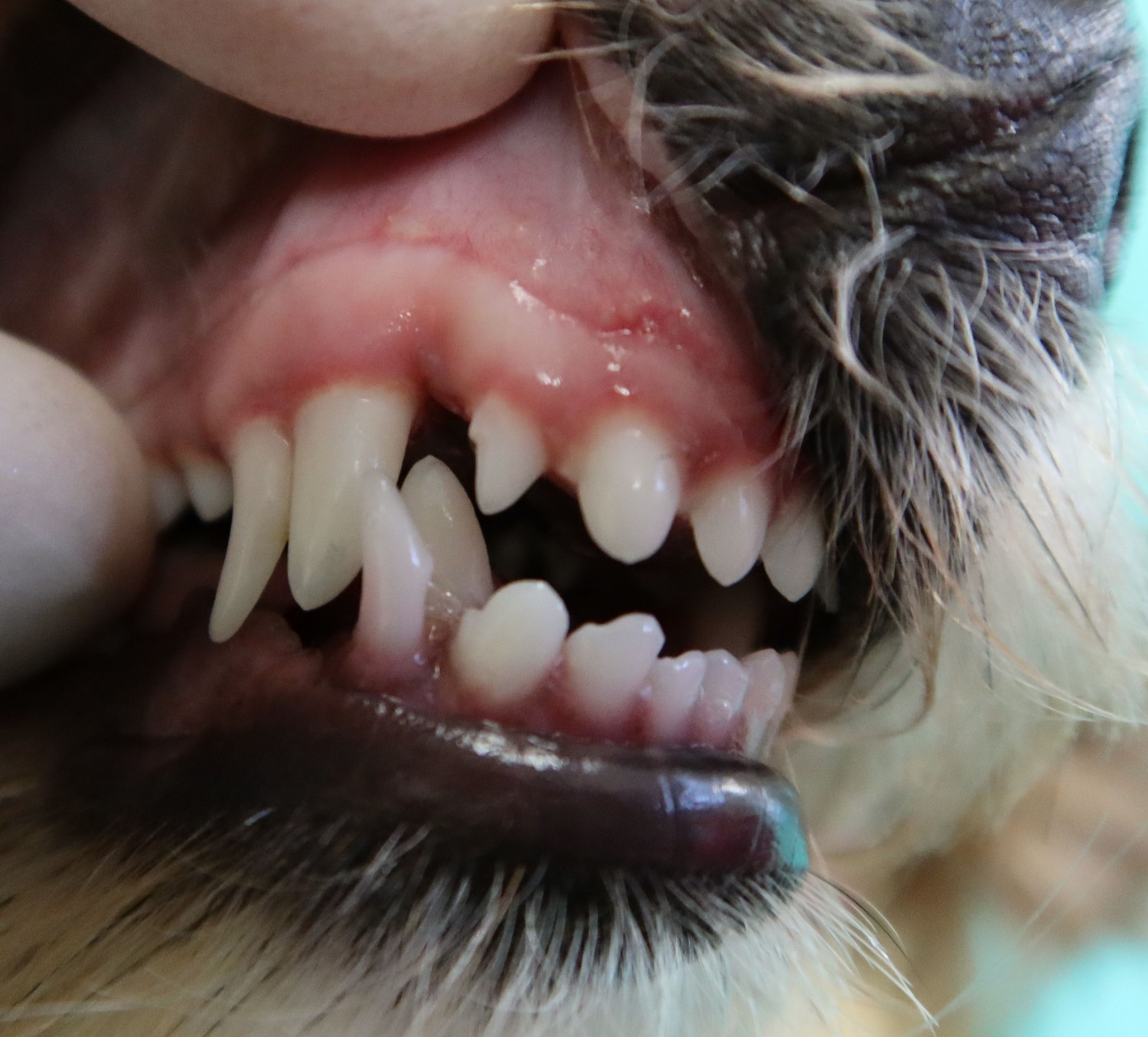 Malocclusion 