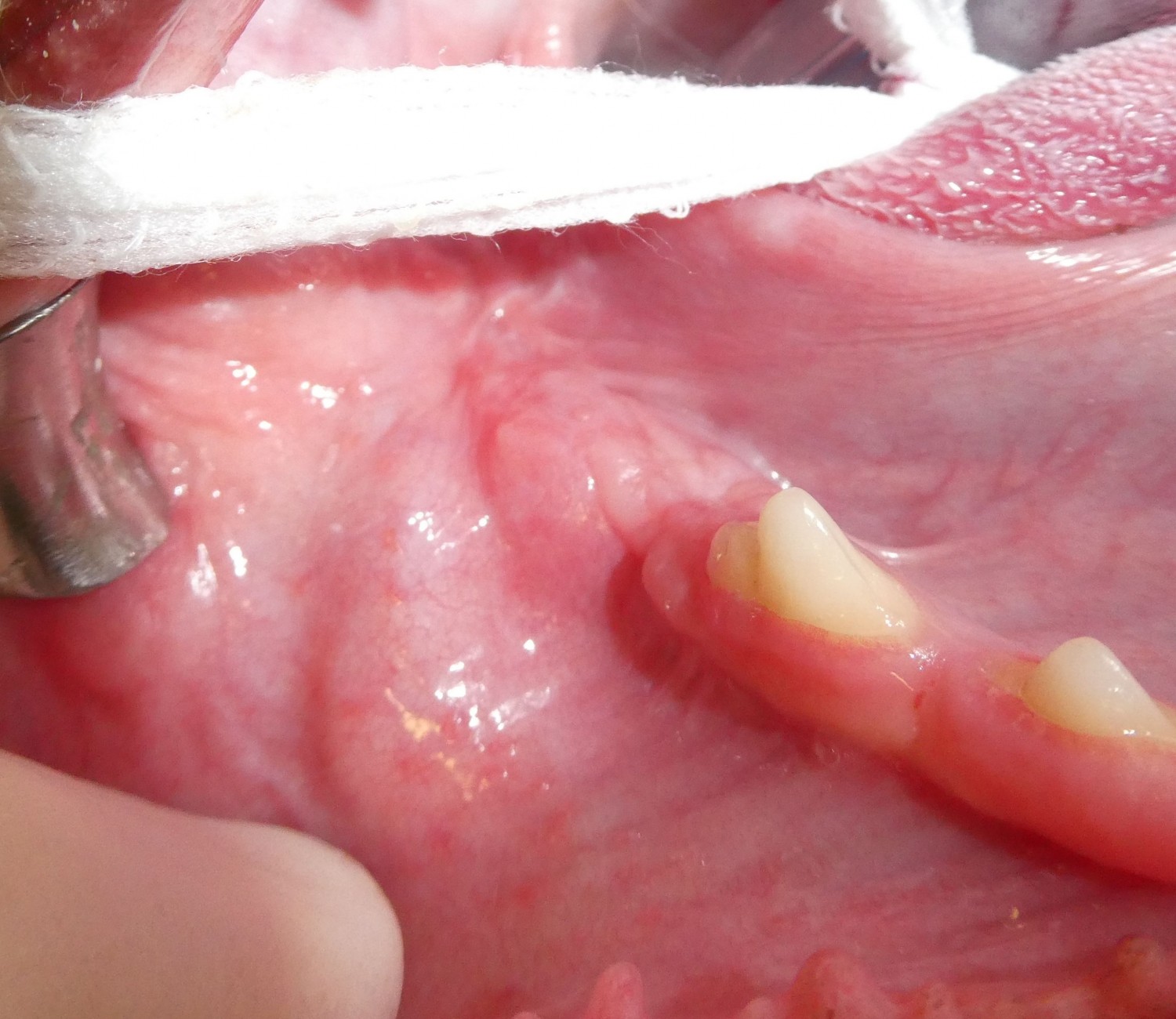 oral mass