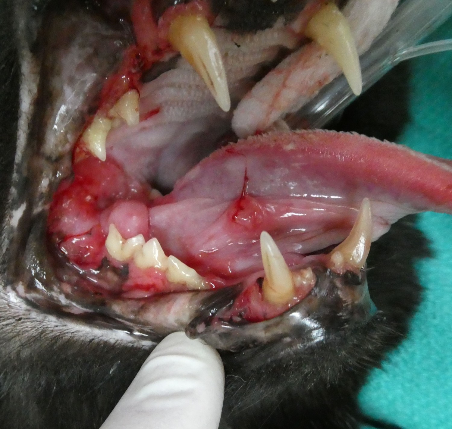 Stomatitis