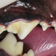 Periodontal disease
