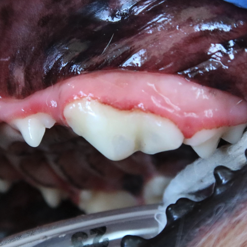 fractured triple-rooted tooth after